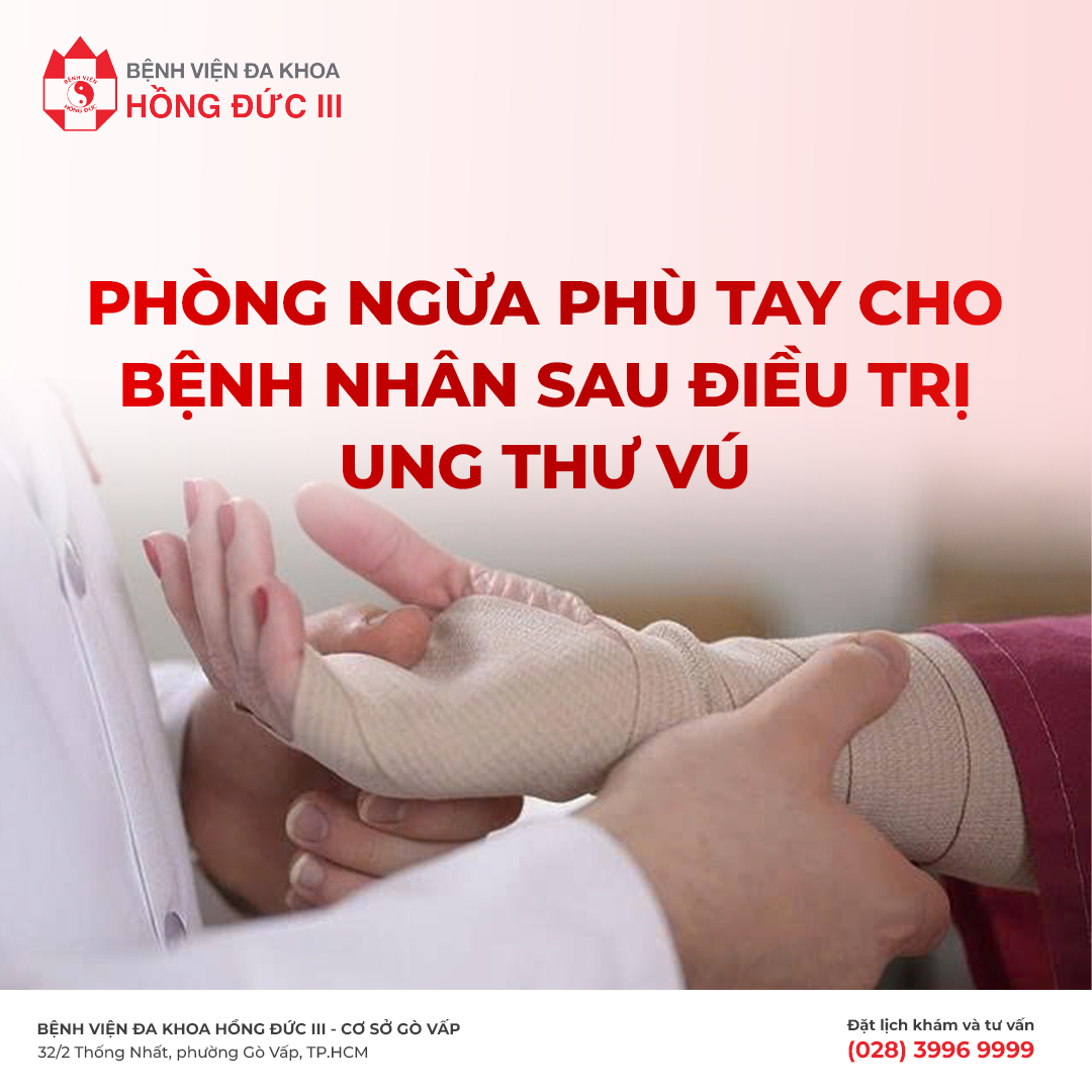 PHÒNG NGỪA PHÙ TAY CHO BỆNH NHÂN SAU ĐIỀU TRỊ UNG THƯ VÚ